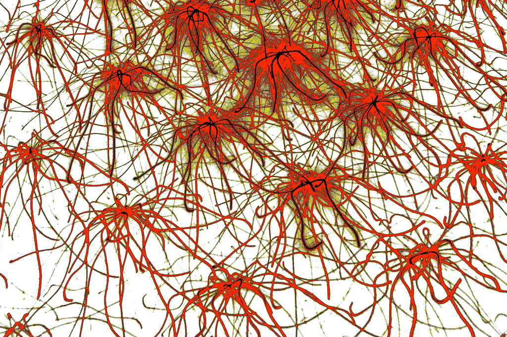 ROTE STERNE NEURONEN – Dichte sternförmige rote Neuronen mit goldenen Verbindungsfäden auf weißem Hintergrund