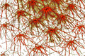 ROTE STERNE NEURONEN – Dichte sternförmige rote Neuronen mit goldenen Verbindungsfäden auf weißem Hintergrund