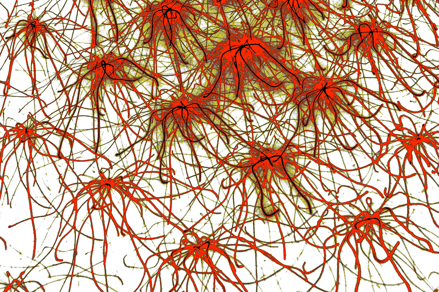 ROTE STERNE NEURONEN — Premium Kunstprint