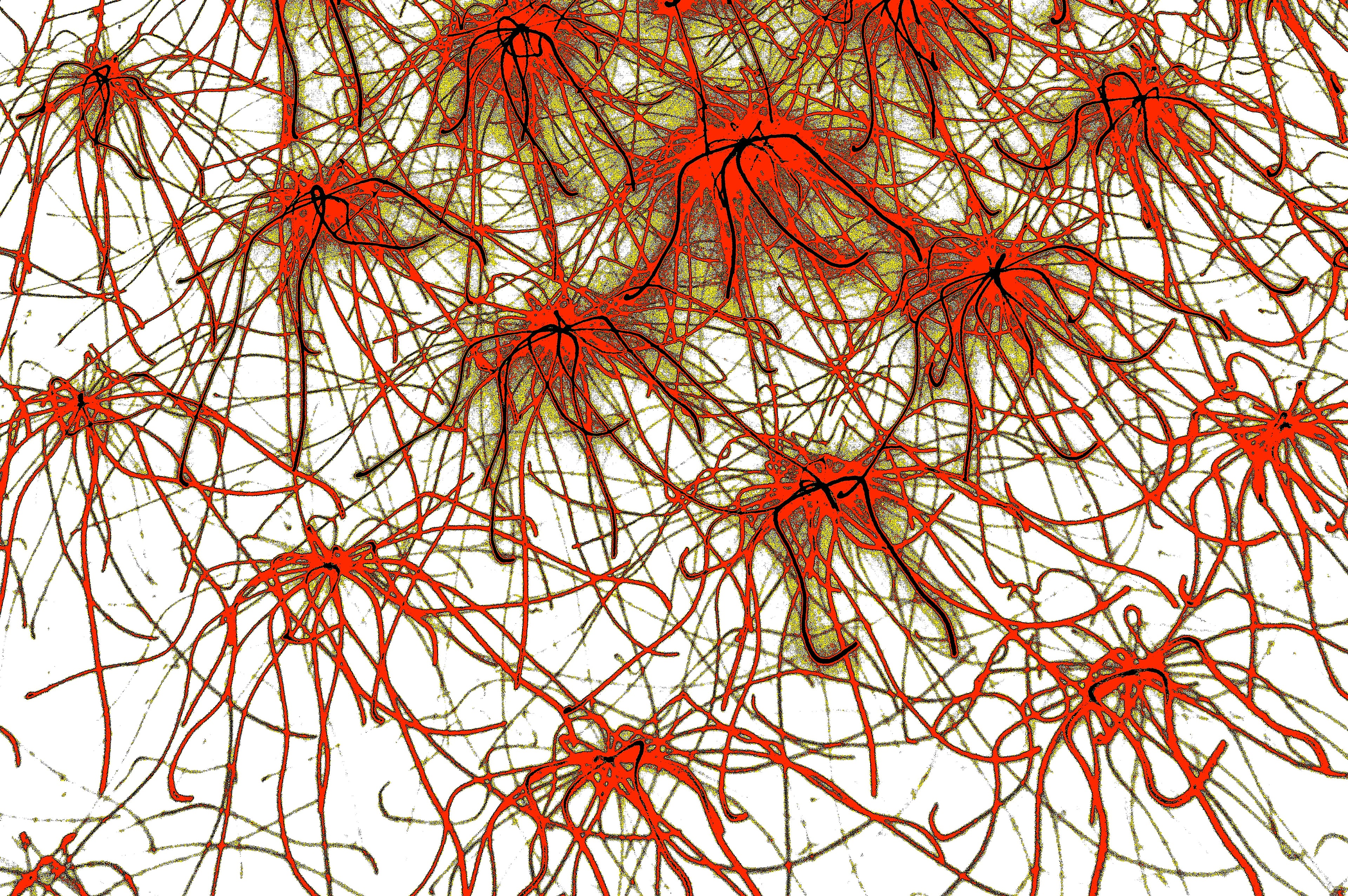 ROTE STERNE NEURONEN – Dichte sternförmige rote Neuronen mit goldenen Verbindungsfäden auf weißem Hintergrund
